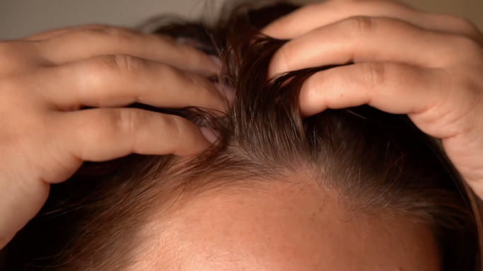 hot water dry scalp